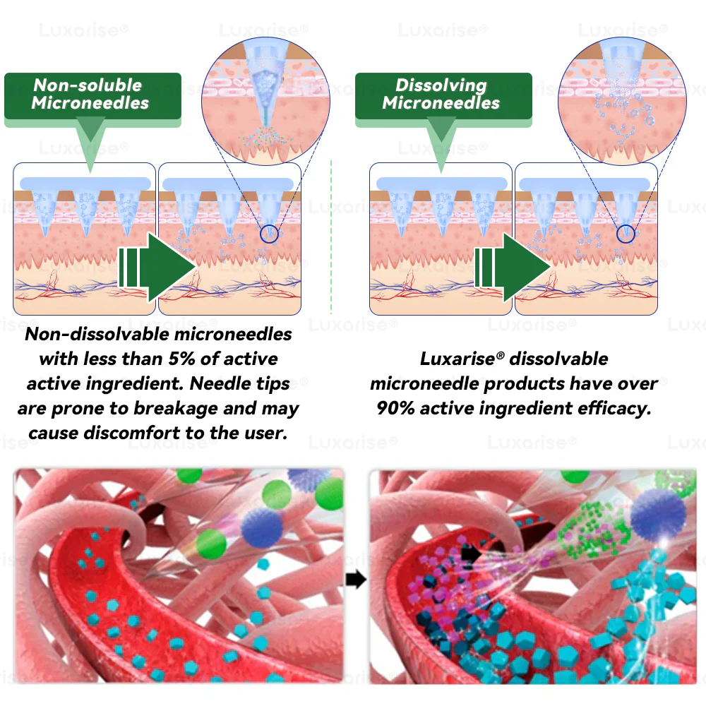 Official Store | 🔥🔥 Luxarise® Moringa × Berberine 10‑in‑1 Advanced Nano Microneedle Patch (Once daily, visible changes in 7 days) - Image 6